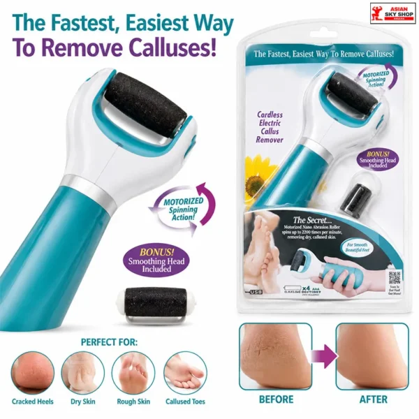 PedEgg Power Cordless Electric Callus Remover