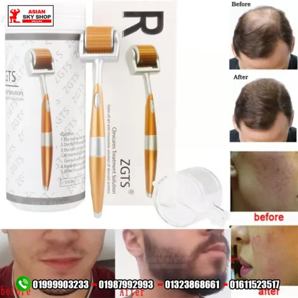 ZGTS Dermaroller Asian sky shop khulna